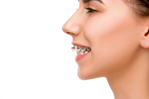 اوربایت چیست و چگونه درمان میشود